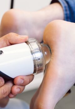 Shockwave therapie bij hielspoor: een effectieve behandeling