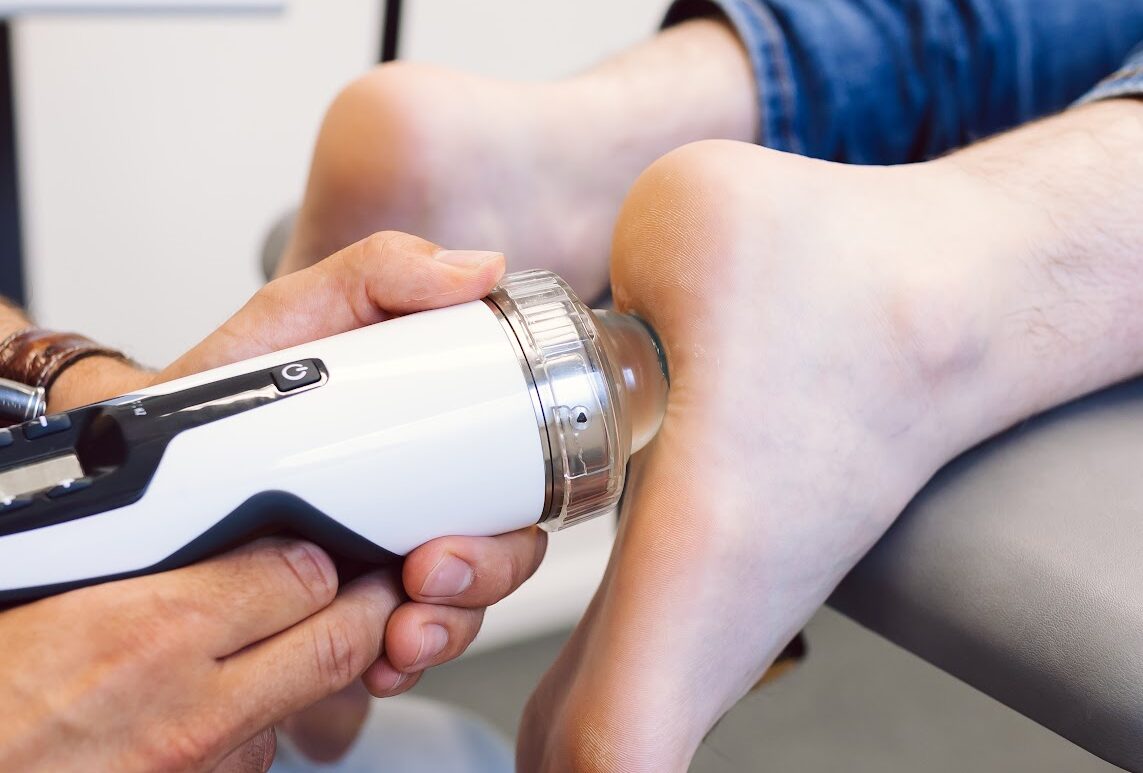 Shockwave therapie bij hielspoor: een effectieve behandeling